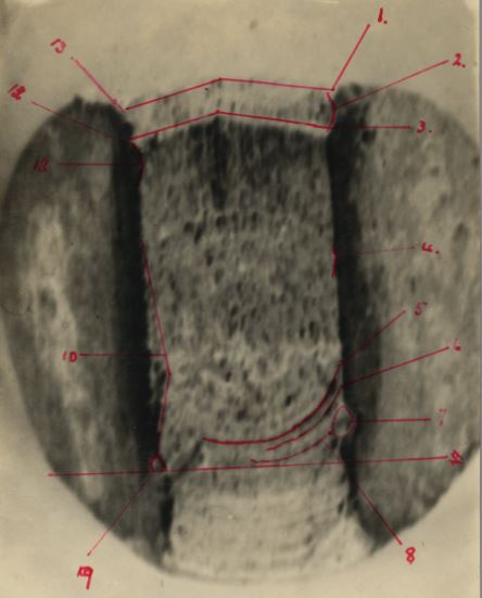 up-close photograph of bullet case with red lines drawn on to show analysis